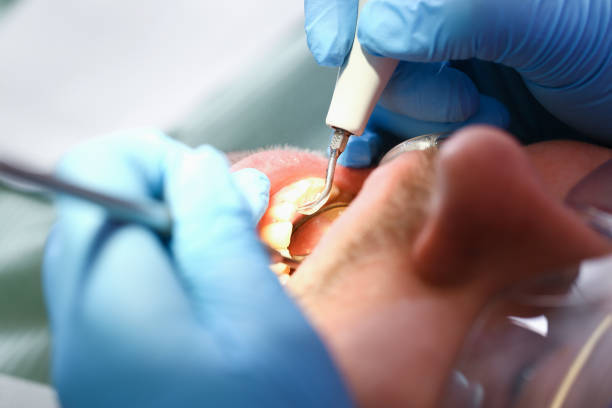 Best Emergency Gum Treatment in Williamsburg, OH