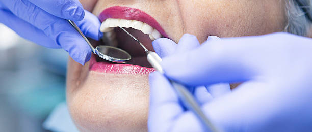 Best Emergency Dental Care for Broken or Chipped Teeth in Williamsburg, OH